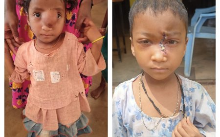 अंजलि को मिला नया जीवन , पिता के साये और आर्थिक तंगी के बीच 'चिरायु योजना' बनी सहारा