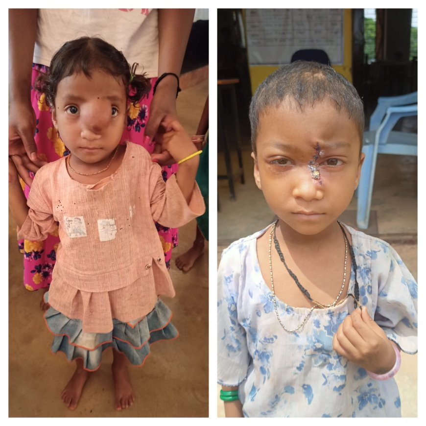 अंजलि को मिला नया जीवन , पिता के साये और आर्थिक तंगी के बीच 'चिरायु योजना' बनी सहारा