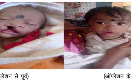 चिरायु टीम की पहल से बच्चे के चेहरे पर लौटी मुस्कान