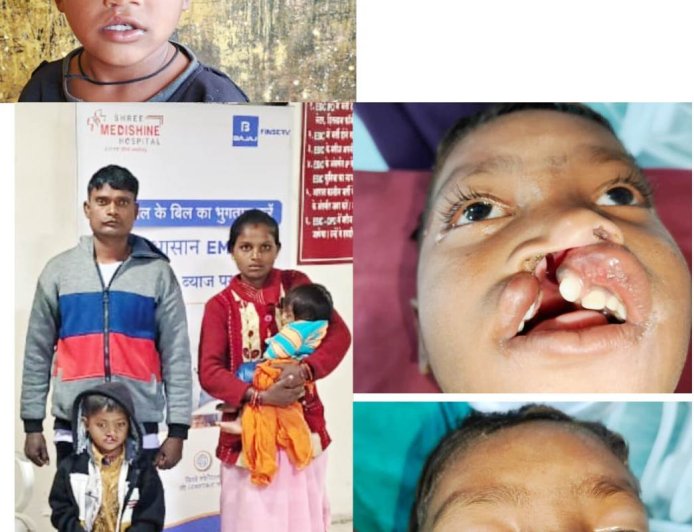 बस्तर के वनांचल से खिलखिलाती मुस्कान की नई इबारत लिख रहा नन्हा विक्रम